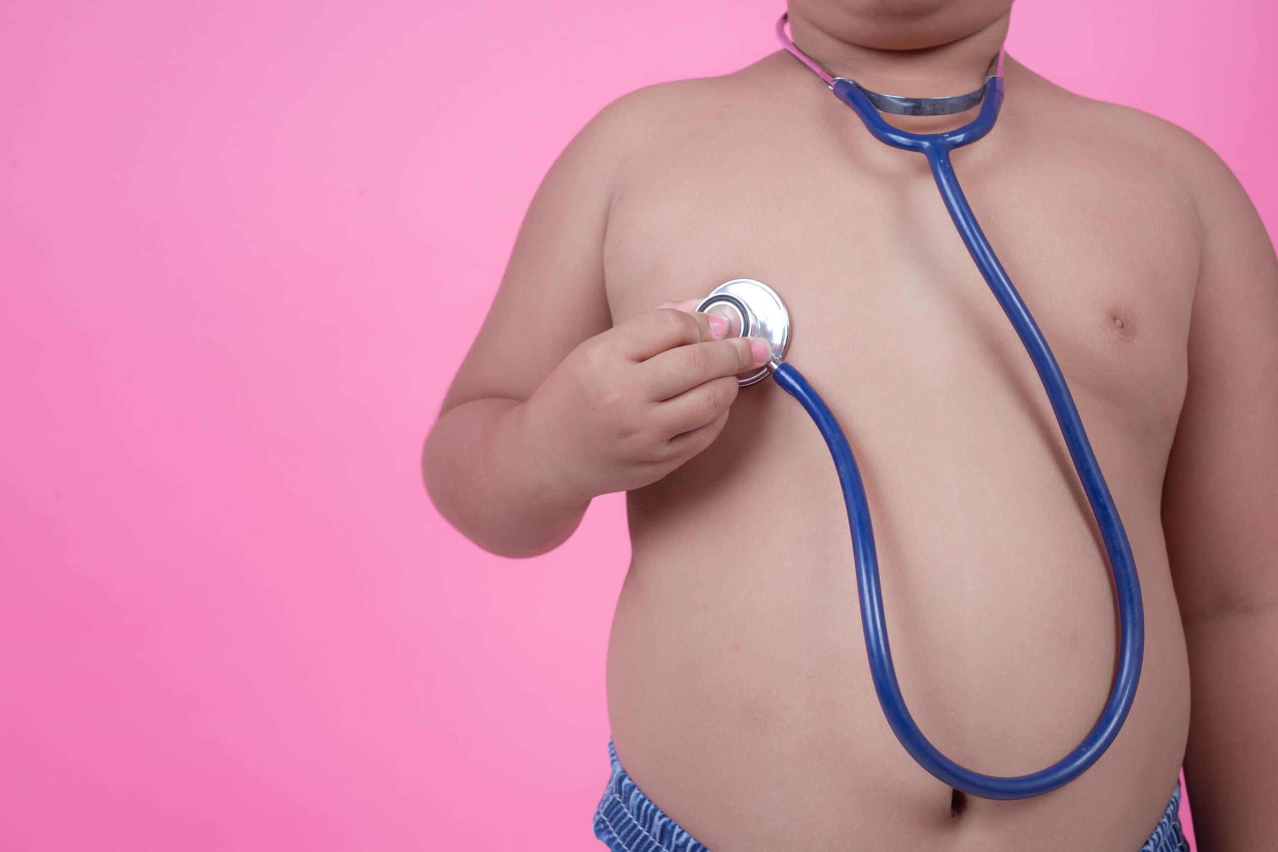 Obesidad y Sobrepeso Infantil y Juvenil